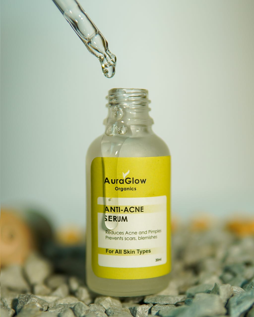 AuraGlow Anti-Acne Serum